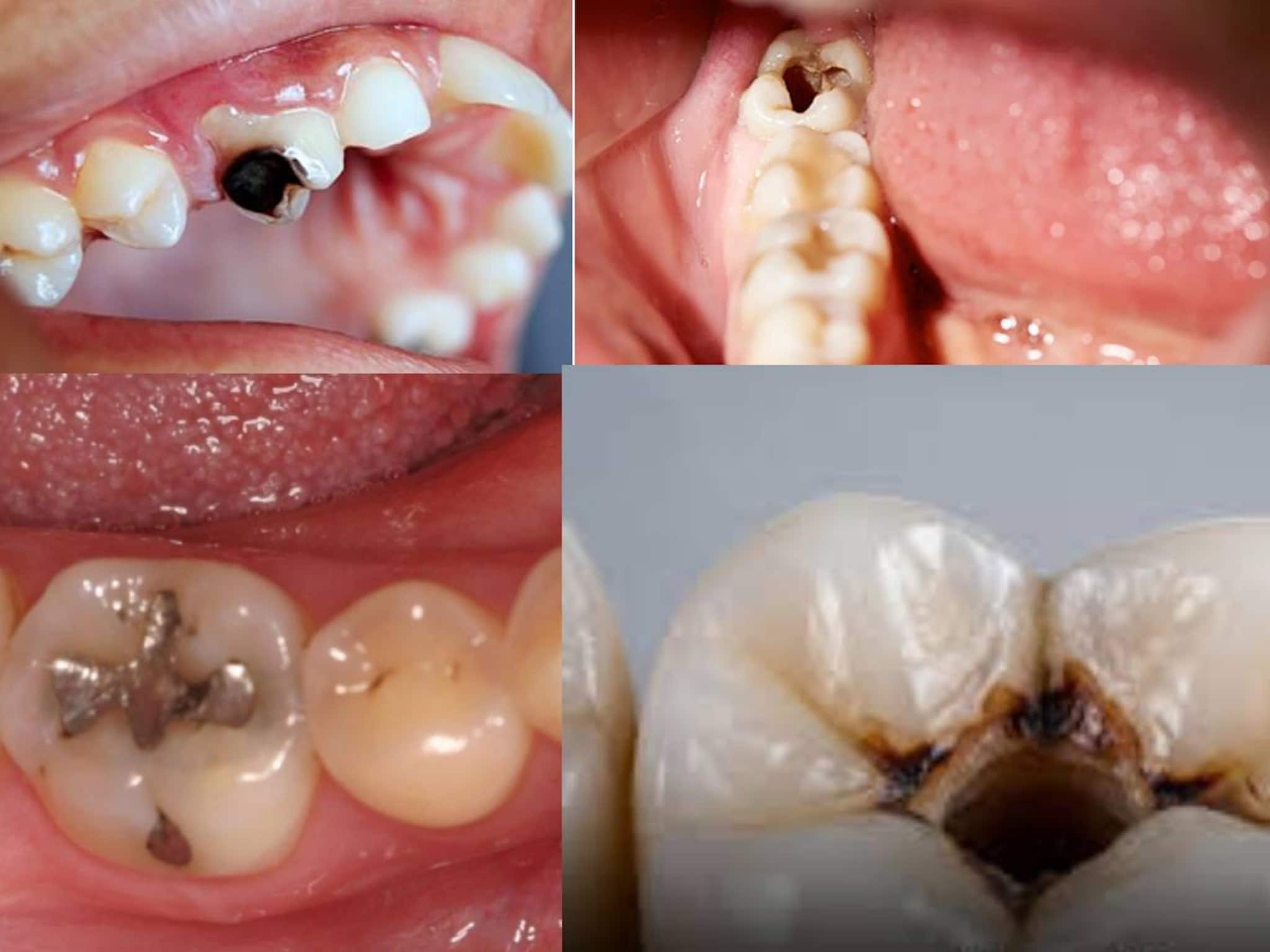 টুথপেস্টের বদলে দাঁত মাজুন নিম-সহ ৪ গাছের ডাল দিয়ে! ভুলবেন পোকা খাওয়া গর্ত দাঁতের ব্যথা! টুথপেস্টের বদলে দাঁত মাজুন নিম-সহ ৪ গাছের ডাল দিয়ে! ভুলবেন পোকা খাওয়া গর্ত দাঁতের ব্যথা!