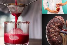 Red Urine: বিট খেলে লাল প্রস্রাব! এই সবজি খেলে তিলে তিলে কিডনির...জানুন চিকিৎসকের মত