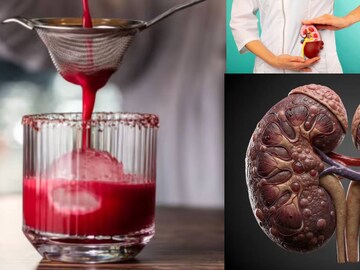 বিট খেলে লাল প্রস্রাব! এই সবজি খেলে তিলে তিলে কিডনির...জানুন চিকিৎসকের মত