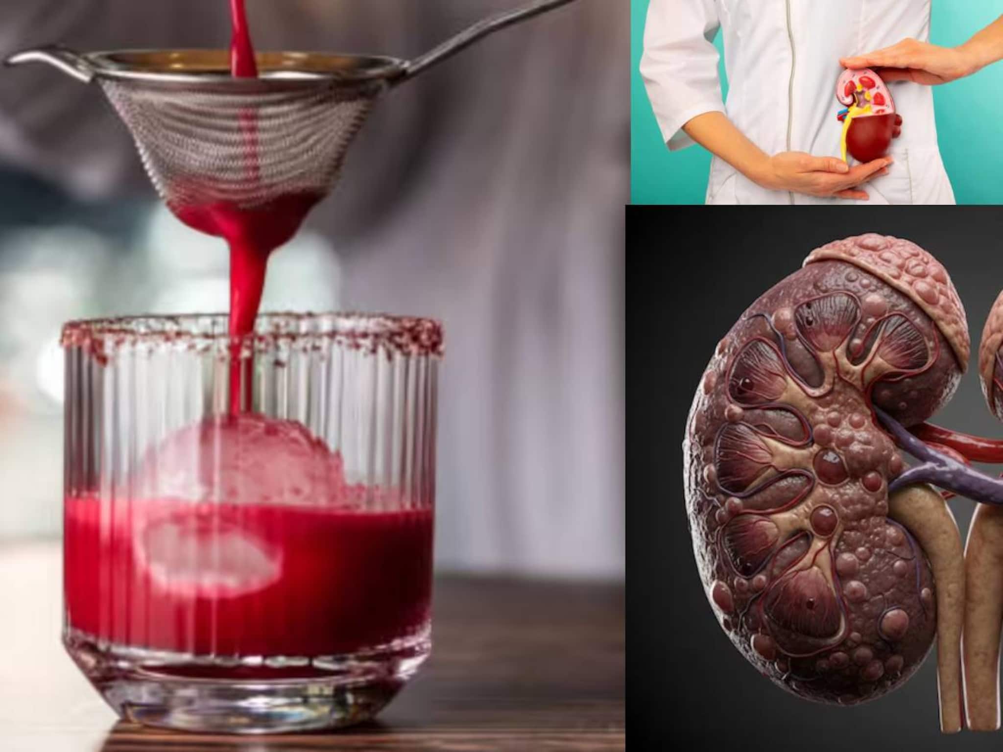 বিট খেলে লাল প্রস্রাব! এই সবজি খেলে তিলে তিলে কিডনির...জানুন চিকিৎসকের মত