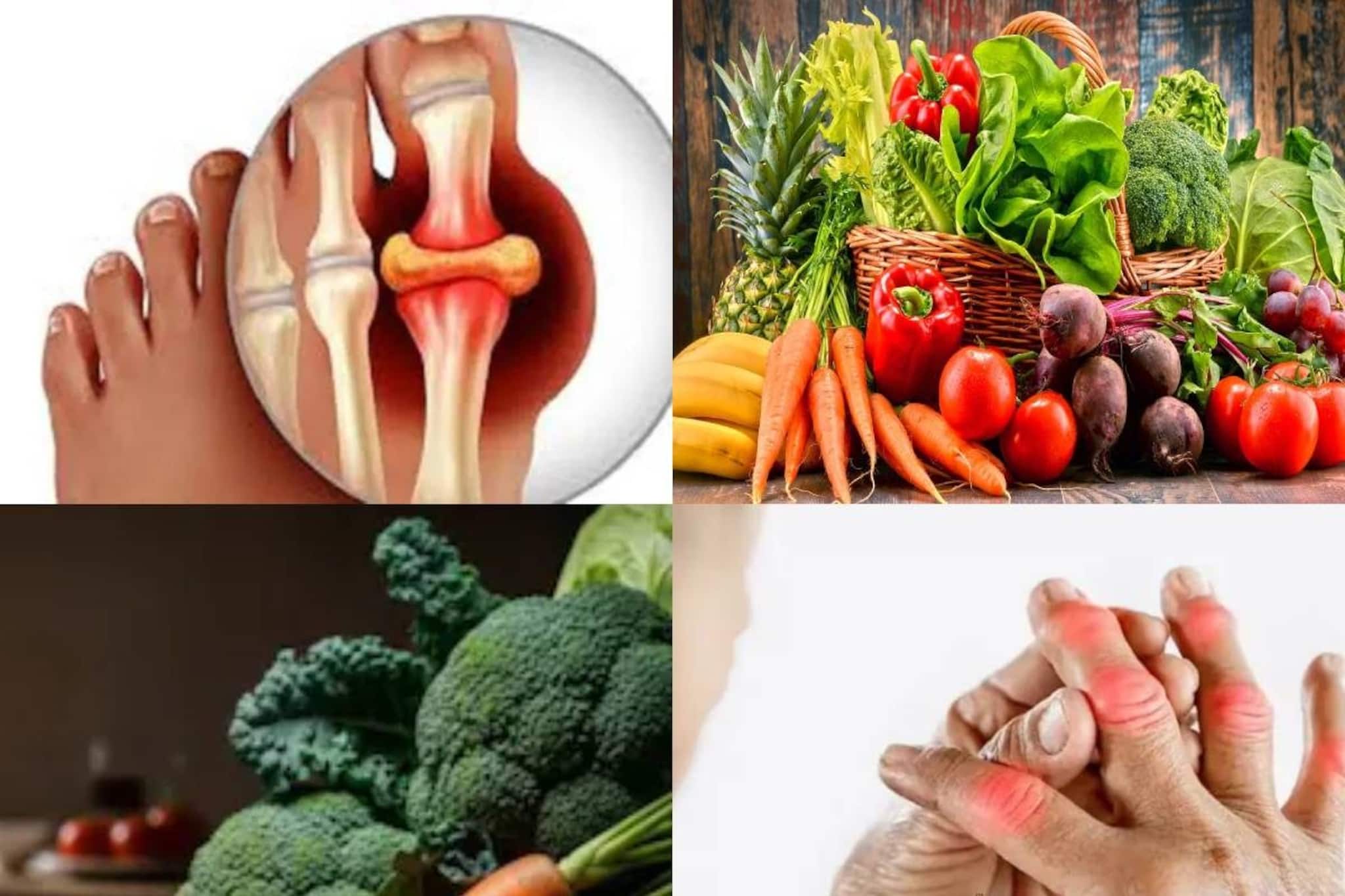 পালক শাক, ফুলকপি-সহ ৪ সবজিতেই ভয়ঙ্কর ক্ষতি! শরীরে জমবে ইউরিক অ্যাসিডের পুরু স্তর!