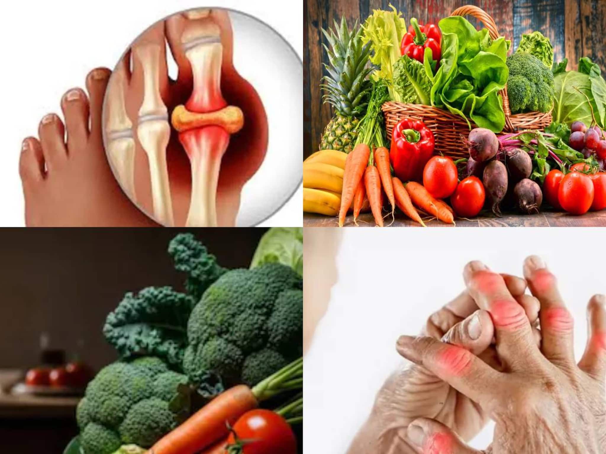 পালক শাক, ফুলকপি-সহ ৪ সবজিতেই ভয়ঙ্কর ক্ষতি! শরীরে জমবে ইউরিক অ্যাসিডের পুরু স্তর! পালক শাক, ফুলকপি-সহ ৪ সবজিতেই ভয়ঙ্কর ক্ষতি! শরীরে জমবে ইউরিক অ্যাসিডের পুরু স্তর!