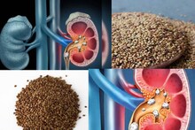 Kidney Stone: রোজ মাত্র ২৫ গ্রাম কুলথি ডাল! এভাবে খেলেই গুঁড়ো গুঁড়ো হয়ে গলে বেরিয়ে যাবে কিডনির পাথর! তবে বেশি খেলেই বিপদ!