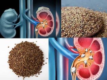 রোজ মাত্র ২৫ গ্রাম কুলথি ডাল! এভাবে খেলেই গুঁড়ো গুঁড়ো হয়ে গলে বেরিয়ে যাবে কিডনির পাথর! রোজ মাত্র ২৫ গ্রাম কুলথি ডাল! এভাবে খেলেই গুঁড়ো গুঁড়ো হয়ে গলে বেরিয়ে যাবে কিডনির পাথর!