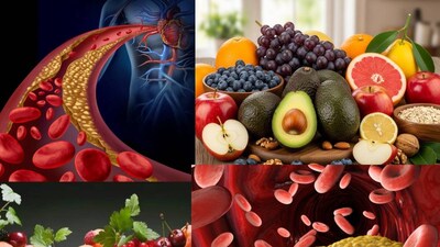 আজকাল উচ্চ কোলেস্টেরলের সমস্যা দ্রুত বৃদ্ধি পাচ্ছে। কোলেস্টেরল আমাদের রক্তে পাওয়া একটি মোমের মতো পদার্থ। যতক্ষণ এটি স্বাভাবিক থাকে, ততক্ষণ এটি স্বাস্থ্যের জন্য ভালো। যখন এর পরিমাণ স্বাভাবিকের চেয়ে বেশি হয়, তখন এটি হার্ট অ্যাটাকের ঝুঁকি বাড়ায় এবং রক্তনালীতে বাধা সৃষ্টি করে। এমন পরিস্থিতিতে এটি নিয়ন্ত্রণে রাখা খুবই গুরুত্বপূর্ণ। বলছেন পুষ্টিবিদ অবনী কৌল৷