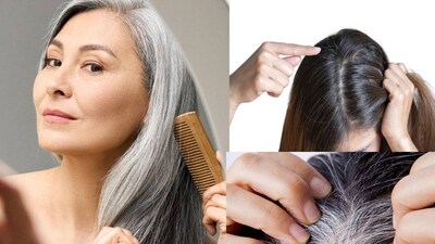 শীতকালে চুল ভেঙে যাওয়া, চুল পড়া এবং পাতলা হয়ে যাওয়া সাধারণ ঘটনা। প্রাচীনকালে, দাদি-দিদিমা চুলে তেল লাগানোকে একটি অপরিহার্য কাজ বলে মনে করতেন। আজও অনেকে স্নানের আগে তেল লাগান, তবে বিশেষজ্ঞরা বলেন যে রাতে তেল লাগানো চুলের বৃদ্ধির জন্য বেশি উপকারী। ঘুমানোর আগে হালকা ম্যাসাজ কেবল চুলের গোড়াকেই নয়, মাথার ত্বককেও প্রশান্ত করে। রাতে তেল লাগালে চুল পড়া কমে, চুল চকচকে হয় এবং চুলের বৃদ্ধি ত্বরান্বিত হয়। আসুন জেনে নেওয়া যাক পাঁচটি চমৎকার তেল সম্পর্কে যা রাতে লাগালে চুলের বৃদ্ধি ত্বরান্বিত করে।