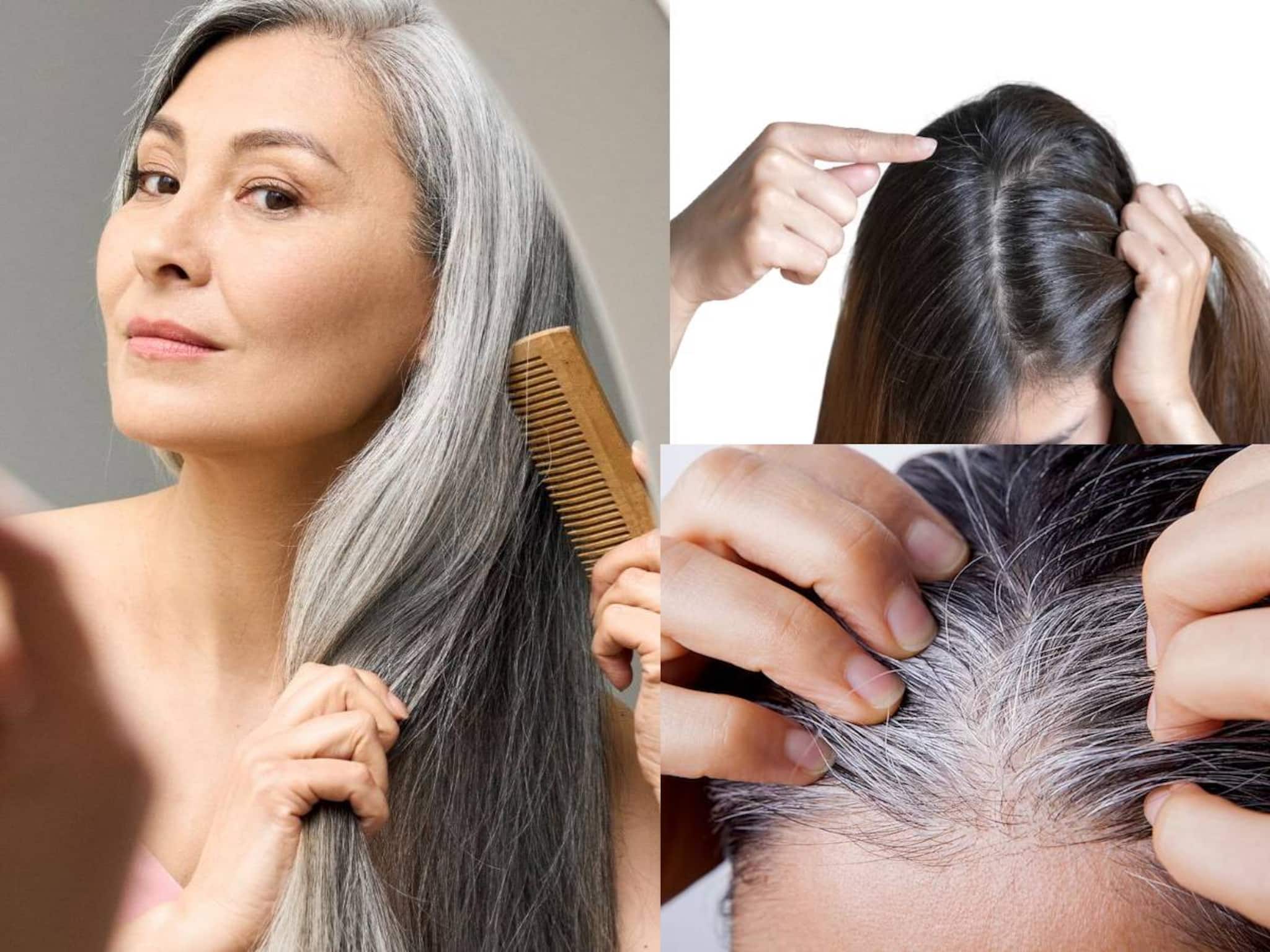 নারকেল, ক্যাস্টর-সহ ৫ তেলের সুপার কামাল! ছোট্ট কাজেই চুল লম্বা হবে তরতরিয়ে! গায়েব সাদা চুল নারকেল, ক্যাস্টর-সহ ৫ তেলের সুপার কামাল! ছোট্ট কাজেই চুল লম্বা হবে তরতরিয়ে! গায়েব সাদা চুল