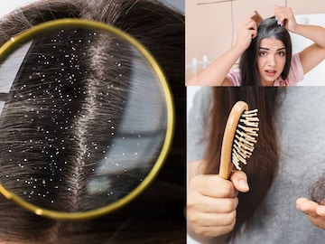 পাল্টে দেবে শীতের খেলা! হেয়ার টনিক-তেলকে দশ গোল! অ্যালোভেরায় সাফ খুশকি, বন্ধ চুল পড়া