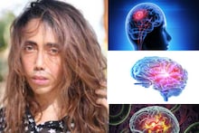Brain TB Symptoms: ব্রেন টিবি-তে আক্রান্ত হন টলিউডের জনপ্রিয় স্টাইলিস্ট স্যান্ডি! কী কী উপসর্গ মস্তিষ্কের যক্ষ্মার? জানুন