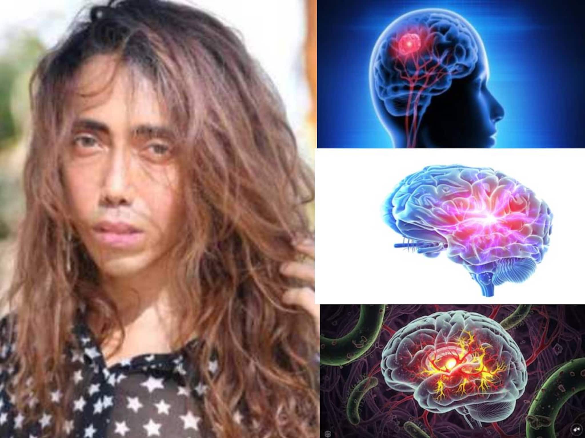 ব্রেন টিবি-তে আক্রান্ত হন টলিউডের স্টাইলিস্ট স্যান্ডি! কী লক্ষণ মস্তিষ্কের যক্ষ্মার? জানুন ব্রেন টিবি-তে আক্রান্ত হন টলিউডের স্টাইলিস্ট স্যান্ডি! কী লক্ষণ মস্তিষ্কের যক্ষ্মার? জানুন