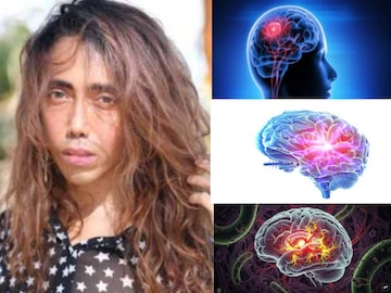 ব্রেন টিবি-তে আক্রান্ত হন টলিউডের স্টাইলিস্ট স্যান্ডি! কী লক্ষণ মস্তিষ্কের যক্ষ্মার? জানুন ব্রেন টিবি-তে আক্রান্ত হন টলিউডের স্টাইলিস্ট স্যান্ডি! কী লক্ষণ মস্তিষ্কের যক্ষ্মার? জানুন