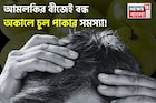 আমলকির বীজ ১ মুঠো! এভাবে মাথায় মাখলেই বন্ধ চুল পাকা! সাদা চুল থেকে মুক্তির জাদুকাঠি!