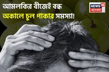 আমলকির বীজ ১ মুঠো! এভাবে মাথায় মাখলেই বন্ধ চুল পাকা! সাদা চুল থেকে মুক্তির জাদুকাঠি!