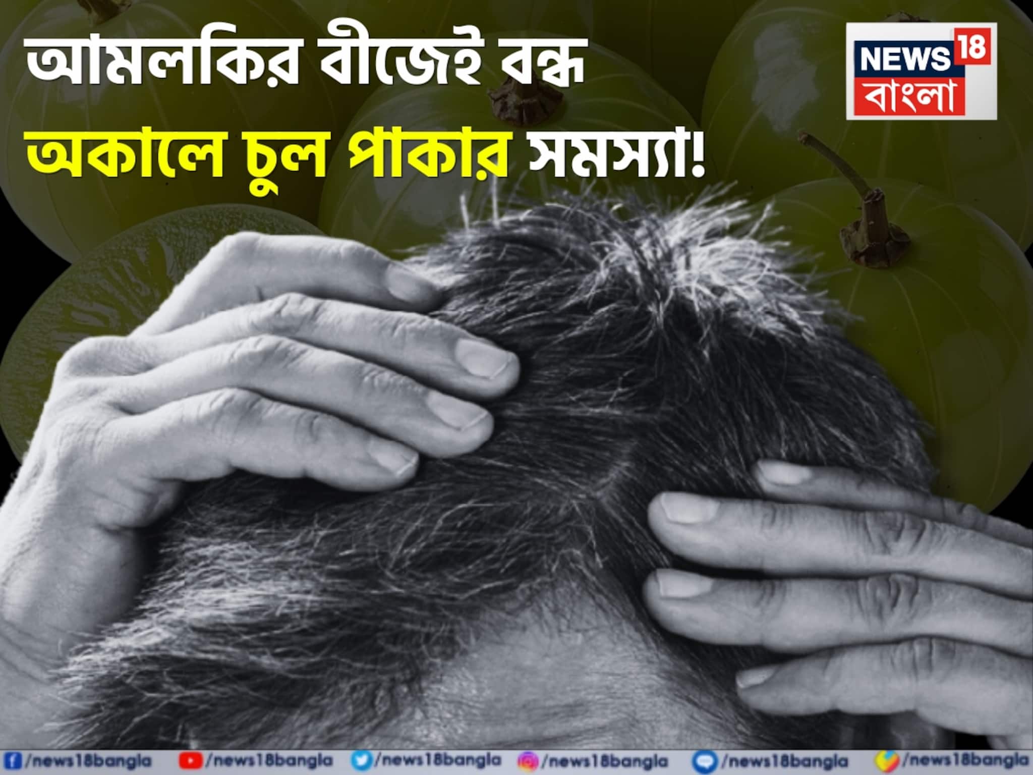 Amla Seeds: আমলকির বীজ ১ মুঠো! গুঁড়ো করে এভাবে মাথায় মাখলেই গোপন মন্ত্রে বন্ধ চুল পাকা! সাদা চুল থেকে মুক্তির জাদুকাঠি!