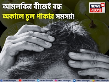 আমলকির বীজ ১ মুঠো! এভাবে মাথায় মাখলেই বন্ধ চুল পাকা! সাদা চুল থেকে মুক্তির জাদুকাঠি! আমলকির বীজ ১ মুঠো! এভাবে মাথায় মাখলেই বন্ধ চুল পাকা! সাদা চুল থেকে মুক্তির জাদুকাঠি!