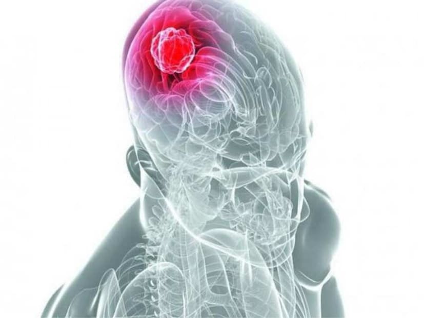 আমরা সকলেই জানি যে টিবি একটি ব্যাকটেরিয়াজনিত সংক্রমণ যা ফুসফুসকে প্রভাবিত করে।হেলথলাইনরোগ নিয়ন্ত্রণ ও প্রতিরোধ কেন্দ্রের মতে, মাইকোব্যাকটেরিয়াম টিউবারকুলোসিস নামক ব্যাকটেরিয়া দ্বারা যক্ষ্মা হয়। 