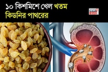 Kidney Stone & UTI: প্রস্রাবে জ্বালাপোড়া? তলপেটে ব্যথা? ১০-১৫ টা কিশমিশেই খেল খতম কিডনিতে জমে থাকা পাথরের! জানুন কীভাবে খাবেন!