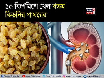১০ কিশমিশ...খেল খতম কিডনির পাথরের! সারবে প্রস্রাবের জ্বলুনি, তলপেটের ব্যথা ১০ কিশমিশ...খেল খতম কিডনির পাথরের! সারবে প্রস্রাবের জ্বলুনি, তলপেটের ব্যথা