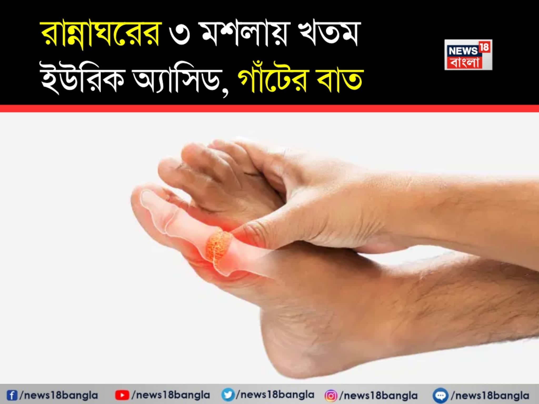 মেথি, জোয়ান, হলুদ...সঠিক পরিমাণে বিশেষ ভাবে খেলেই জব্দ ইউরিক অ্যাসিড! গাঁটের ব্যথাও শেষ মেথি, জোয়ান, হলুদ...সঠিক পরিমাণে বিশেষ ভাবে খেলেই জব্দ ইউরিক অ্যাসিড! গাঁটের ব্যথাও শেষ