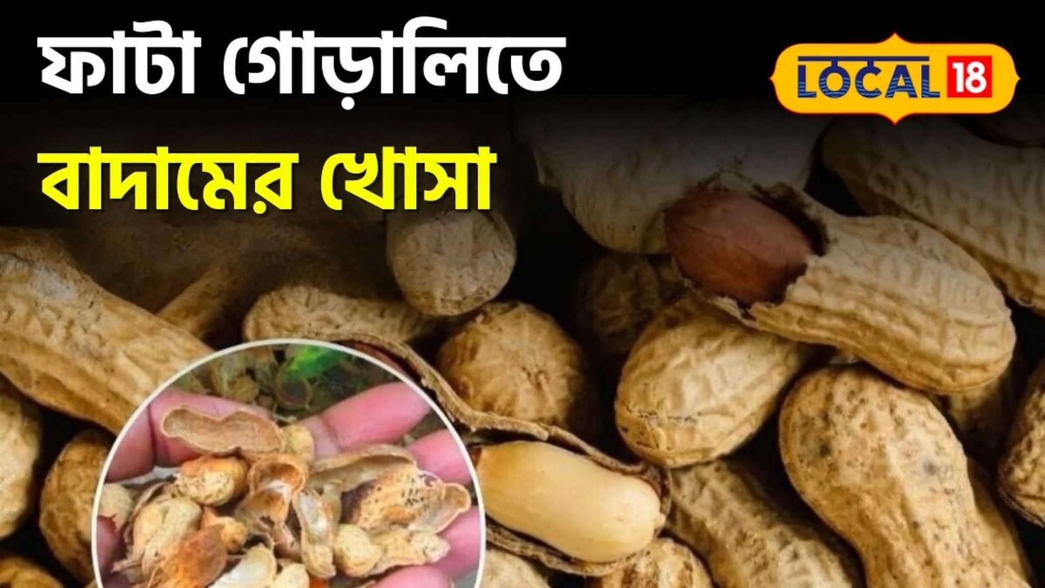 crack heel remedy at home : রান্নাঘরেই লুকিয়ে বিউটির সিক্রেট! বাদামের খোসা দেয় দারুণ কাজ...তুলতুলে হয় ঠোঁট, মোলায়েম গোড়ালি
