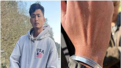 Dehradun Racial Attack: MBA Student Angel Chakma Dies After Brutal Assault, 5 Arrested