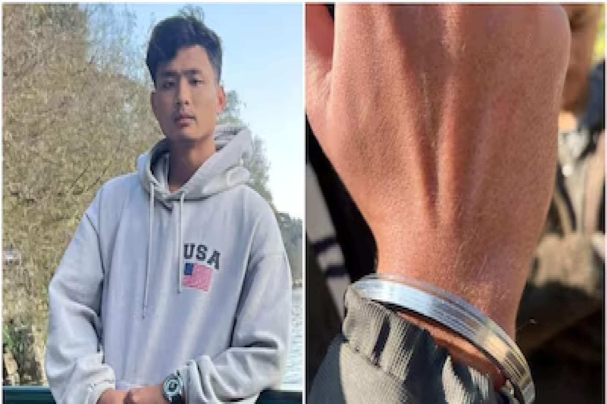 দেরাদুনের উত্তর-পূর্বের তরুণকে মৃত্যুর দিকে ঠেলে দিয়েছিল ব্যাপক মার, ছুরির সঙ্গে ছিল গয়না দেরাদুনের উত্তর-পূর্বের তরুণকে মৃত্যুর দিকে ঠেলে দিয়েছিল ব্যাপক মার, ছুরির সঙ্গে ছিল গয়না