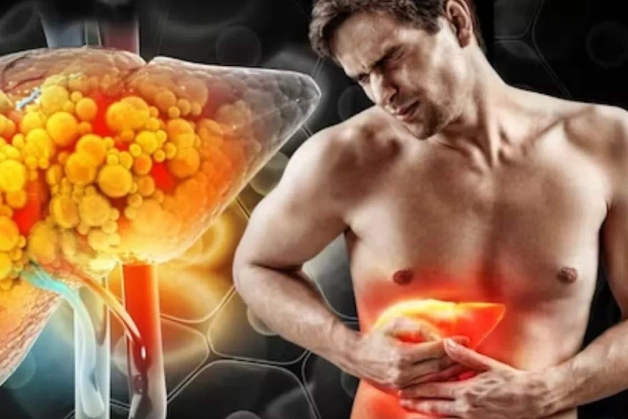 কম বয়সেই ক্ষতি হতে পারে লিভারের, তড়িখড়ি বাদ দিন বেশ কয়েকটি খাবার! বিপদ বাড়বে কিন্তু