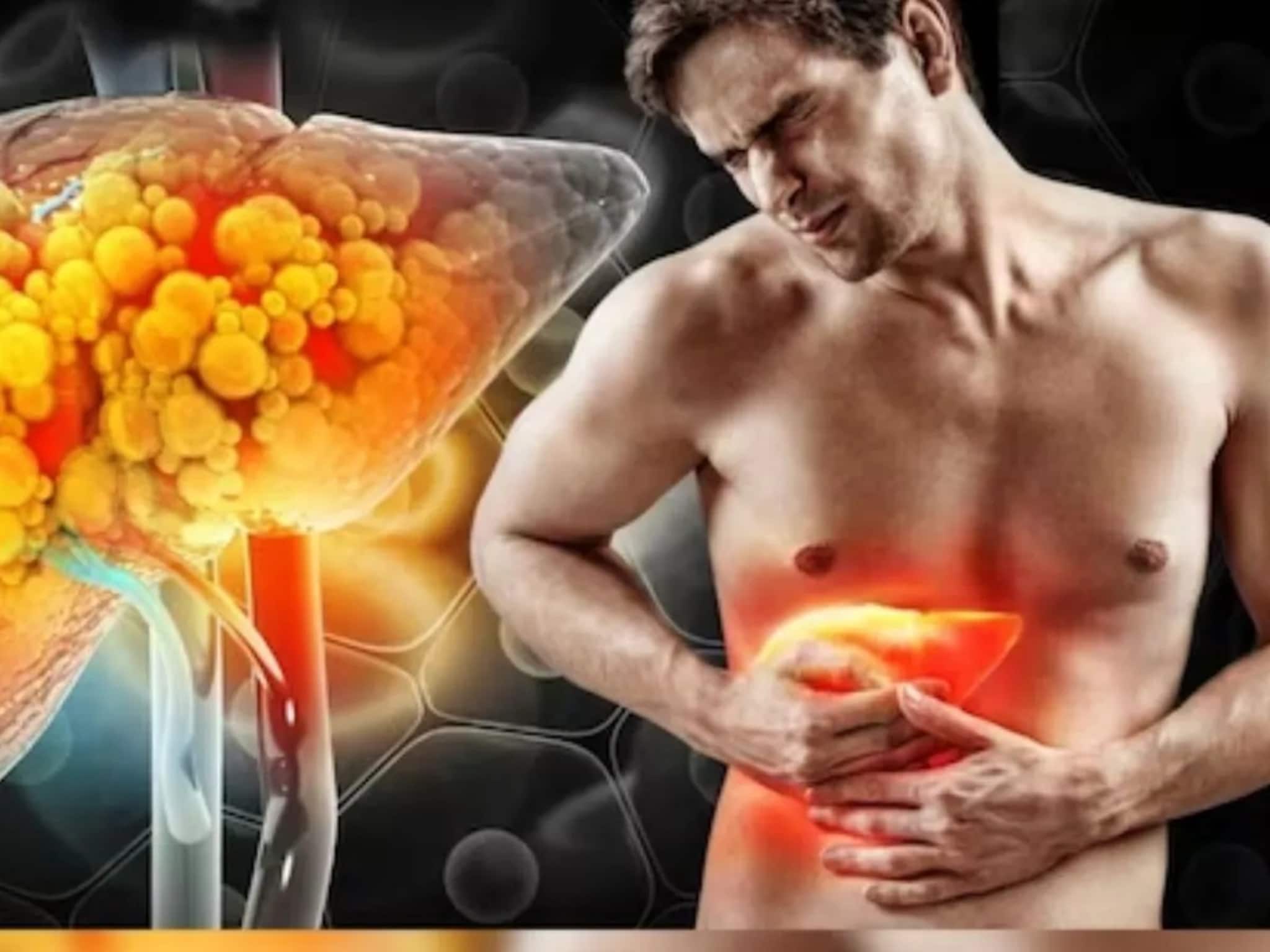 কম বয়সেই ক্ষতি হতে পারে লিভারের, তড়িখড়ি বাদ দিন বেশ কয়েকটি খাবার! বিপদ বাড়বে কিন্তু