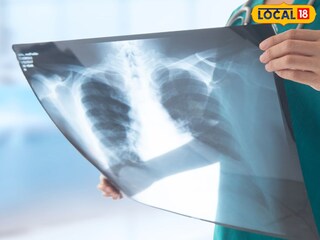 এক্স-রে প্লেট (প্রতীকী ছবি)