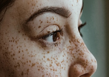 ত্বকে বাদামী দাগছোপ বা ফ্রেকলস? কসমেটিক্স নয়, জেনে নিন কোন ভিটামিনের অভাবে এমনটা হয় ত্বকে বাদামী দাগছোপ বা ফ্রেকলস? কসমেটিক্স নয়, জেনে নিন কোন ভিটামিনের অভাবে এমনটা হয়