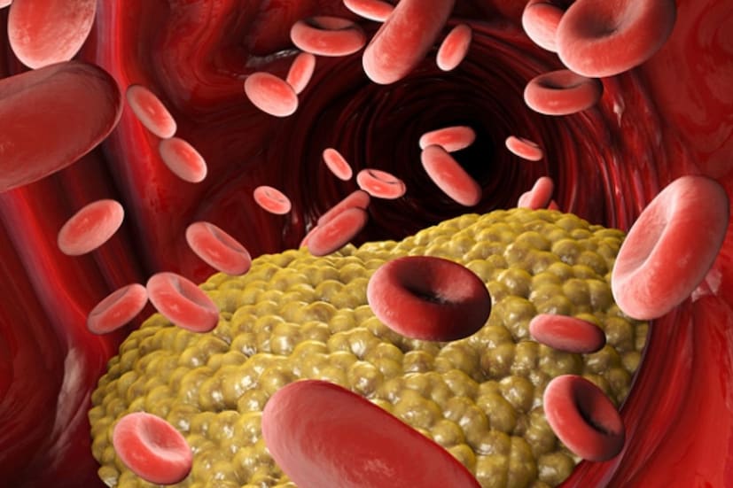 রসুন শরীরে রক্ত ​​চলাচলও বাড়ায়। এতে উপস্থিত অ্যালিসিন নামক যৌগটির কারণে এর প্রকৃতি গরম। এতে আমাদের শরীরে রক্ত ​​চলাচল বৃদ্ধি পায়। 