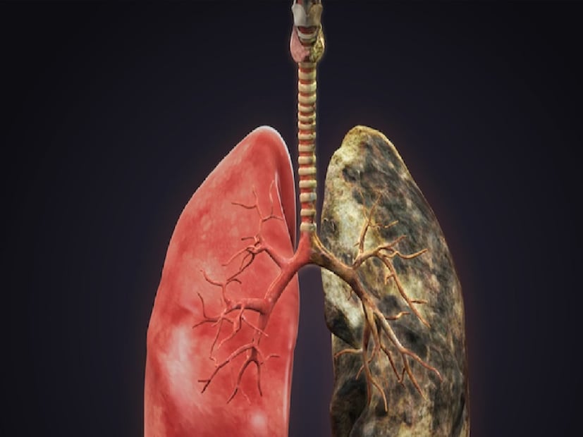 গত দশকে উন্নত অস্ত্রোপচার, টার্গেটেড থেরাপি এবং ইমিউনোথেরাপির মাধ্যমে চিকিৎসা-পদ্ধতিতে অভাবনীয় অগ্রগতি হয়েছে। মলিকিউলার টেস্টিংয়ের মাধ্যমে এখন রোগীর ক্যান্সারের জেনেটিক গঠন বোঝা যায় এবং সেই অনুযায়ী নির্দিষ্ট চিকিৎসা দেওয়া সম্ভব, যার ফলে রোগীর আয়ু এবং জীবনযাত্রার মান উল্লেখযোগ্যভাবে উন্নত হয়েছে।