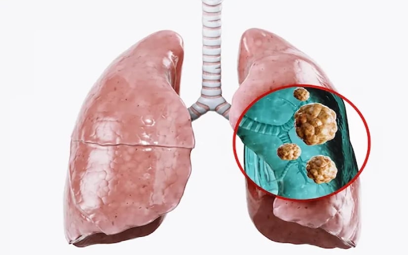 বায়ুদূষণ এখন দেশে দ্বিতীয় বৃহত্তম ঝুঁকি, এবং মহানগরগুলিতে পরিস্থিতি আরও উদ্বেগজনক। বিশ্বে ঘরের ভিতরের দূষণ কোথাও কোথাও কমেছে ঠিকই, কিন্তু নিম্ন-মধ্য আয়ের দেশে এখনও রান্নার জন্য কাঠ, কয়লা বা বায়োমাস জ্বালানি ব্যবহারের ফলে ঝুঁকি খুব বেশি।