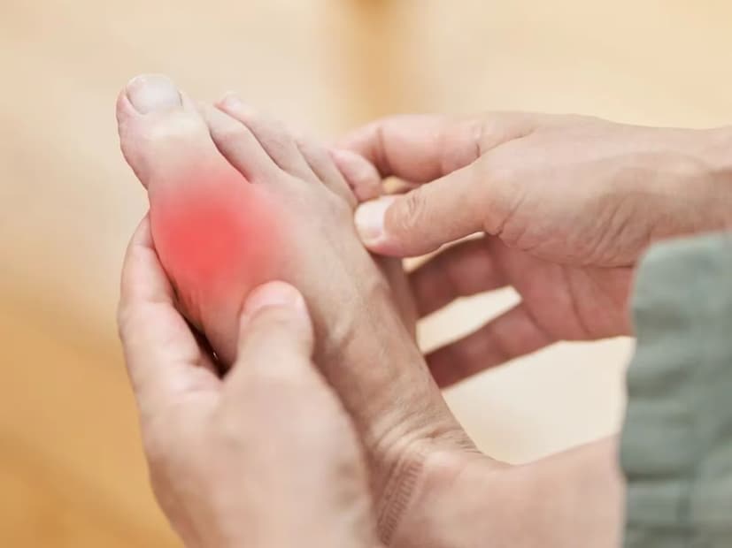 আপনার যদি উচ্চ কোলেস্টেরল বা উচ্চ ইউরিক অ্যাসিড লেভেলের সমস্যা থাকে, তাহলে কাঁচা রসুন চিবিয়ে সকালে খালি পেটে খান। মাত্র দুই কোয়া রসুন খেলে উপকার পাবেন। 