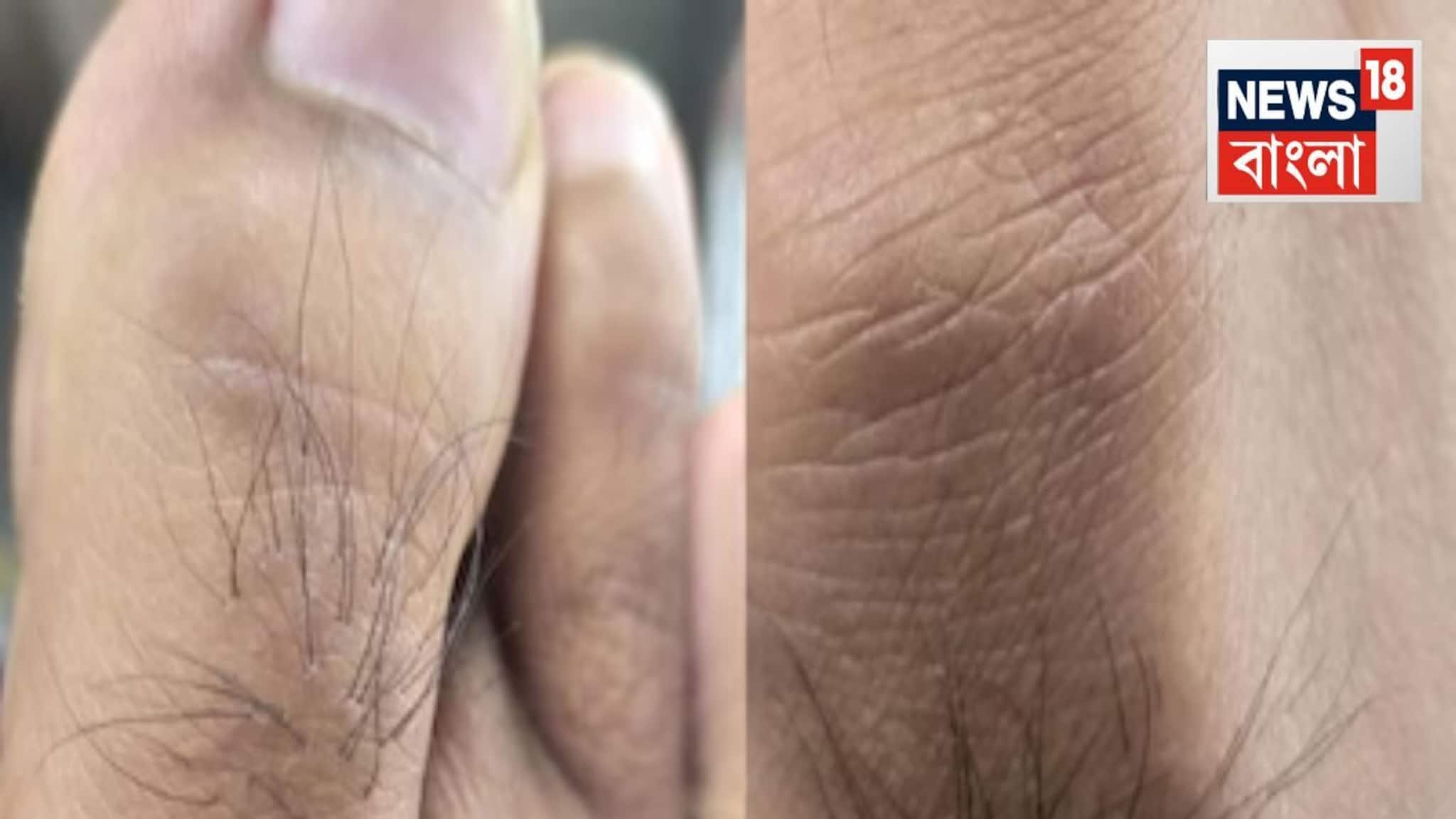 Toe Hair Sign for Health: পায়ের বুড়ো আঙুলে চুল...ব্লাড সুগার থেকে হৃৎপিণ্ডের স্বাস্থ্য! আভাস দেয় অনেক কিছুর, বলছেন চিকিৎসক