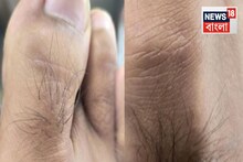Toe Hair Sign for Health: পায়ের বুড়ো আঙুলে চুল...ব্লাড সুগার থেকে হৃৎপিণ্ডের স্বাস্থ্য! আভাস দেয় অনেক কিছুর, বলছেন চিকিৎসক