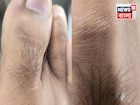পায়ের বুড়ো আঙুলে চুল...ব্লাড সুগার থেকে হৃৎপিণ্ডের স্বাস্থ্য! আভাস দেয় অনেক কিছুর