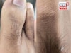 পায়ের বুড়ো আঙুলে চুল...ব্লাড সুগার থেকে হৃৎপিণ্ডের স্বাস্থ্য! আভাস দেয় অনেক কিছুর