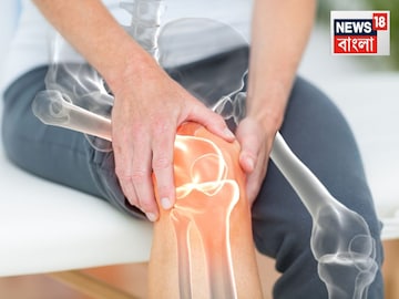 ঘি, দুধ, হলুদ ও নুন...জয়েন্টের কটকটে ব্যথায় দেয় বড্ড আরাম! শীতকালে ব্যবহারের আদর্শ নিয়ম ঘি, দুধ, হলুদ ও নুন...জয়েন্টের কটকটে ব্যথায় দেয় বড্ড আরাম! শীতকালে ব্যবহারের আদর্শ নিয়ম