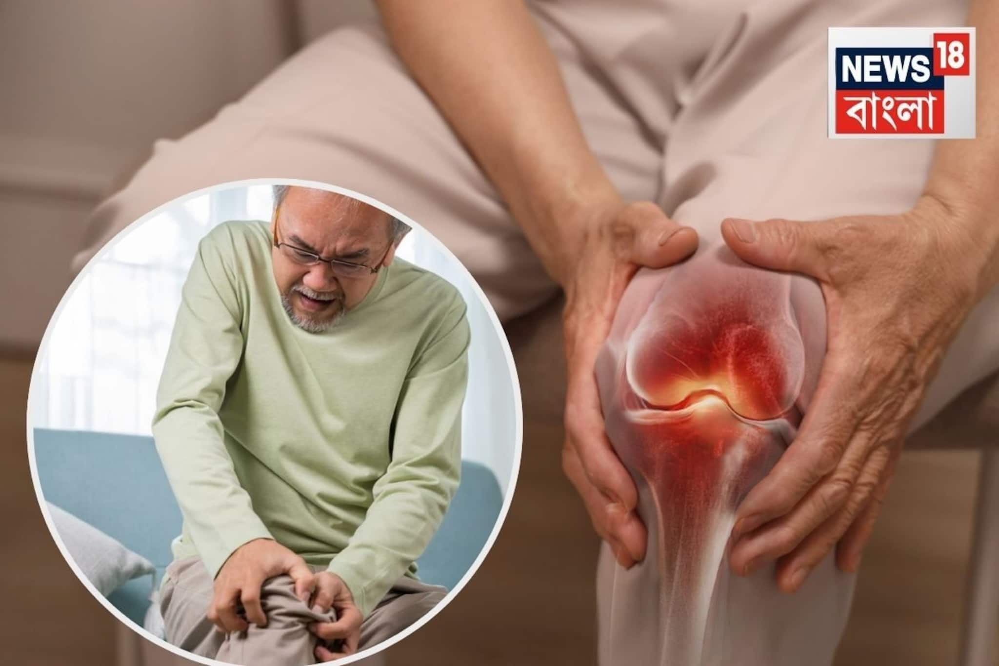 ঘি, দুধ, হলুদ ও নুন...জয়েন্টের কটকটে ব্যথায় দেয় বড্ড আরাম! শীতকালে ব্যবহারের আদর্শ নিয়ম