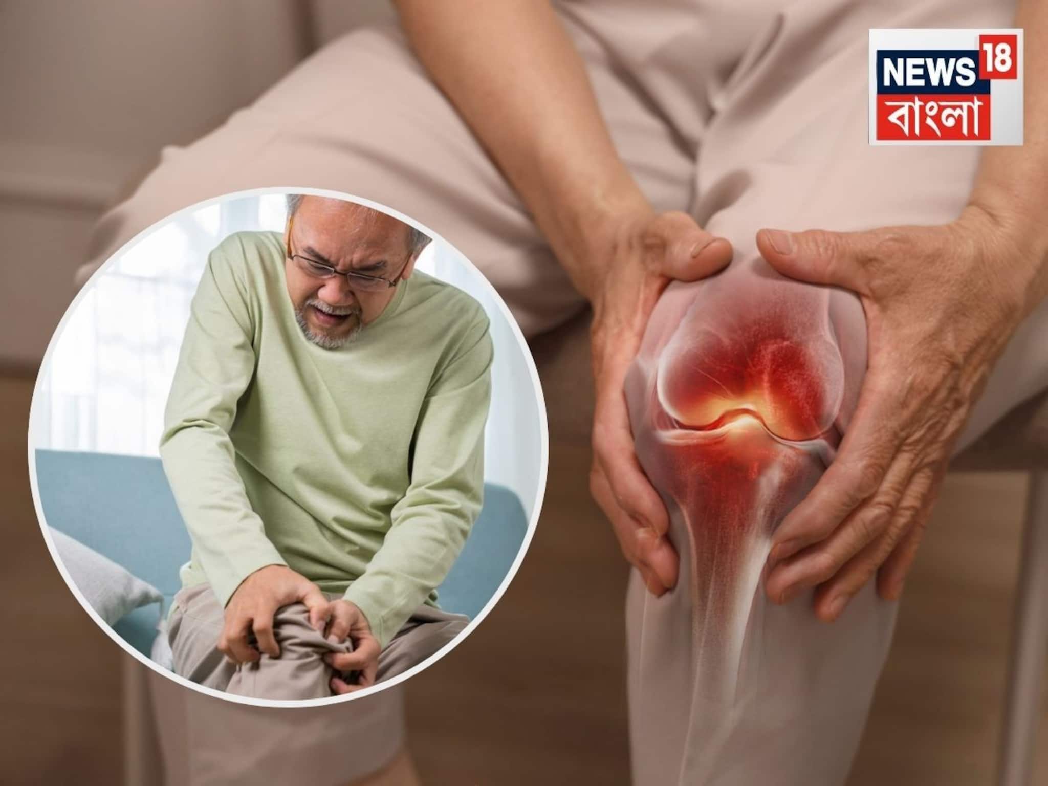 Joint Pain Ayurvedic Relief: ঘি, দুধ, হলুদ আর নুন...জয়েন্টের কটকটে ব্যথায় দেয় বড্ড আরাম! শীতকালে ব্যবহারের আদর্শ নিয়ম জানালেন আয়ুষ চিকিৎসক