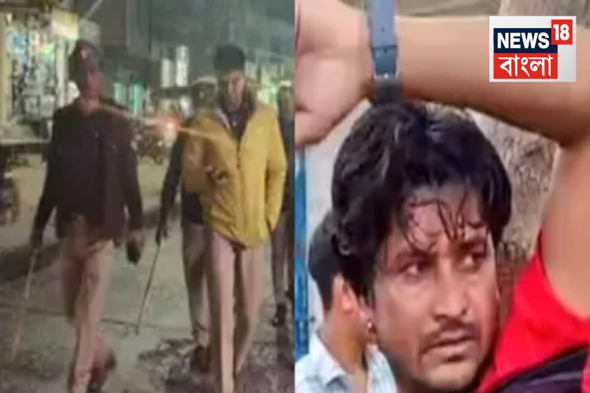 দেহ টুকরো টুকরো করে ছড়ানো..কোথাও হাত, তো কোথাও মাথা! খুনি স্ত্রীয়ের কীর্তি ফাঁস করল পুলিশ