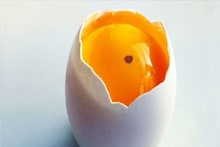 Blood Spot in Egg Yolk: ডিমের কুসুমে রক্তের দাগ, খেয়াল করেছেন কখনও? এমন ডিম খেয়ে ফেললে শরীরে কী হয়? জেনে নিন