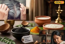 White Hair Home Remedy: অল্প বয়সেই পাক ধরছে চুলে! নারকেল নিয়ে করুন 'সহজ' উপায়, সাদা চুল দিন কয়েকেই উধাও! মাথা ভরবে কালো চুলে