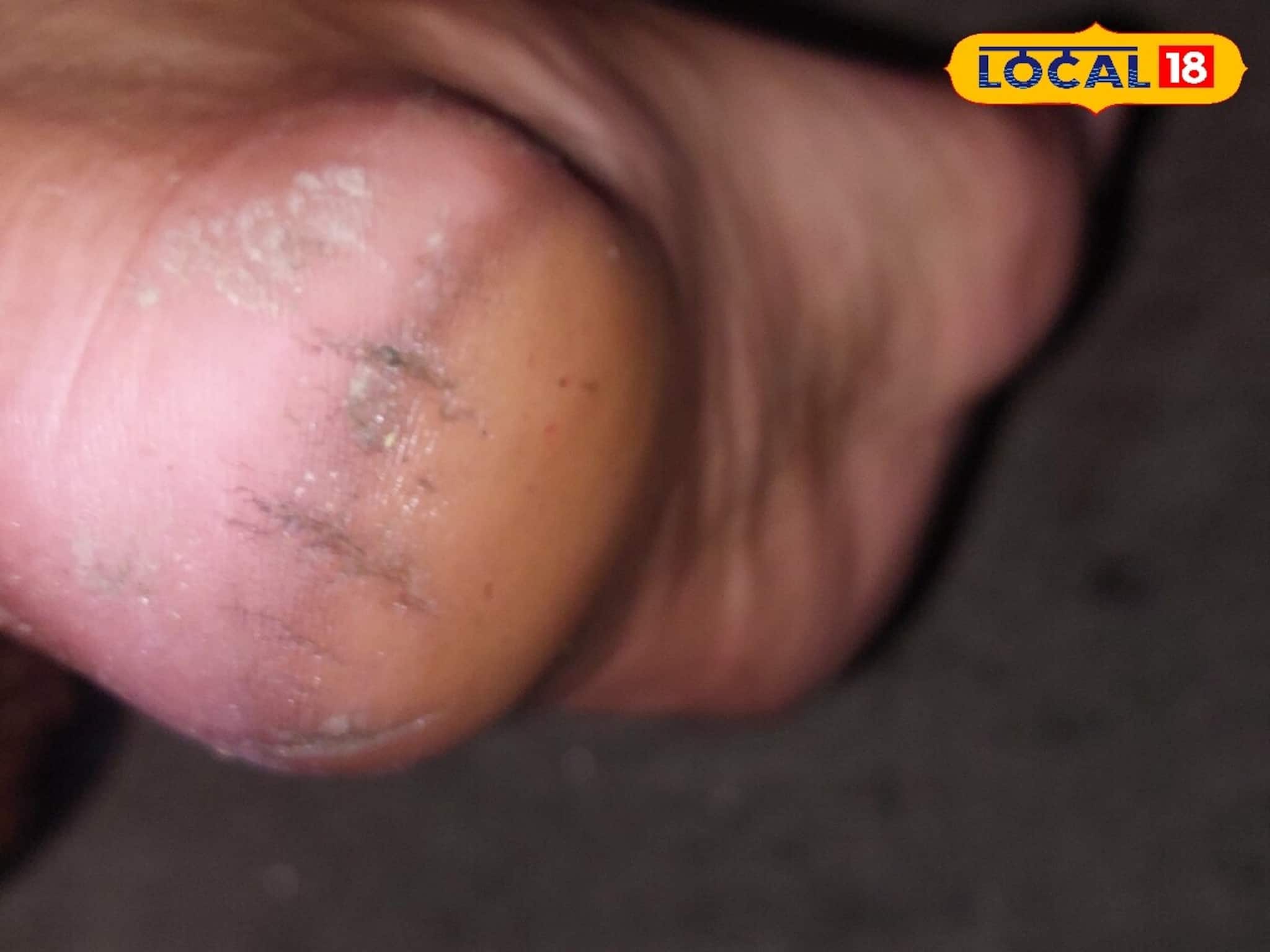 ফাটা গোড়ালি থেকে মিলবে মুক্তি! নারকেল তেল, অ্যালোভেরা ও লেবুর এই রামবাণেই পা থাকবে সুন্দ