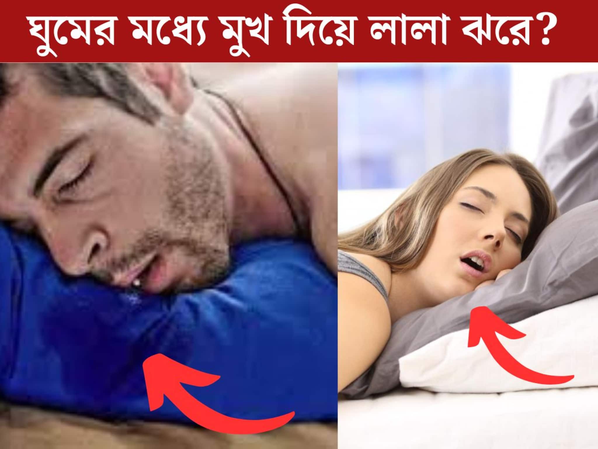 বলুন তো কোন ভিটামিনের অভাবে রাতে ঘুমের মধ‍্যে মুখ দিয়ে লালা ঝরে? কোন সমস‍্যার লক্ষণ?