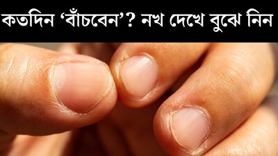 কতদিন ‘বাঁচবেন’? আয়ুর বড় ‘ক্লু’ লুকিয়ে রয়েছে নখেই! নিজে দেখেই বুঝতে পারবেন কীভাবে? জানুন