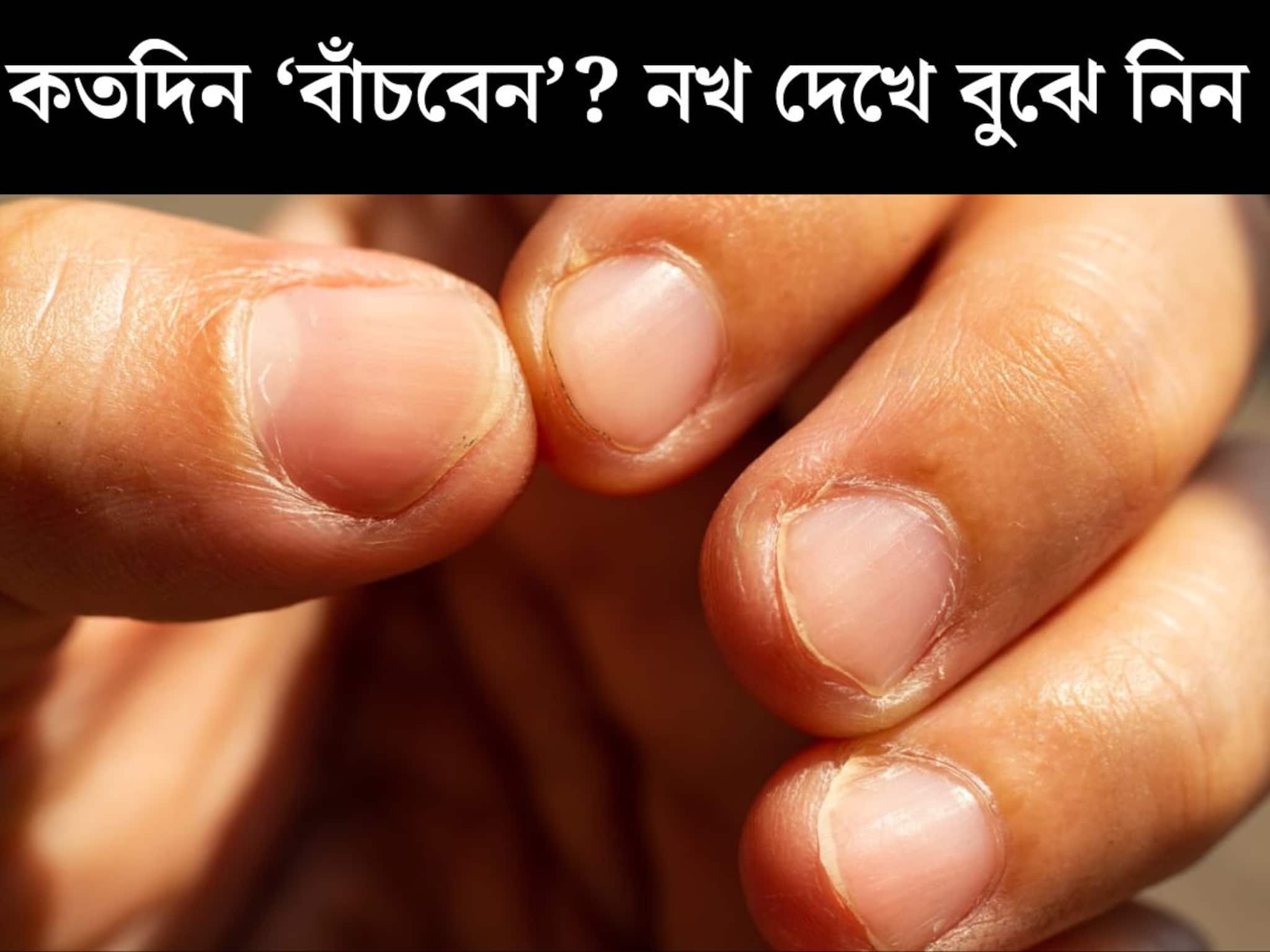 কতদিন ‘বাঁচবেন’? আয়ুর বড় ‘ক্লু’ লুকিয়ে রয়েছে নখেই! নিজে দেখেই বুঝতে পারবেন কীভাবে?