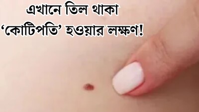 ‘কোটিপতি’ হওয়ার লক্ষণ! শরীরের ঠিক এই জায়গায় তিল থাকলেই হাতে আসবে মুঠো মুঠো টাকা, ভাগ্যের রহস্য খুলে দেবে ছোট্ট তিল