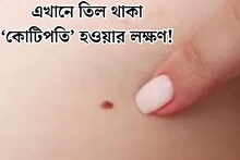 Mole: ‘কোটিপতি’ হওয়ার লক্ষণ! শরীরের ঠিক এই জায়গায় তিল থাকলেই হাতে আসবে মুঠো মুঠো টাকা, ভাগ্যের রহস্য খুলে দেবে ছোট্ট তিল